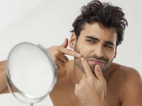 home remedies to cure acne marks2