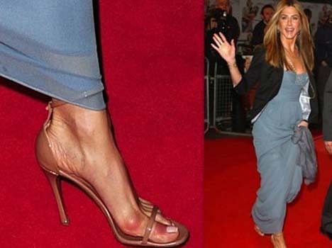 Beautiful celebrities with ugly feet. 