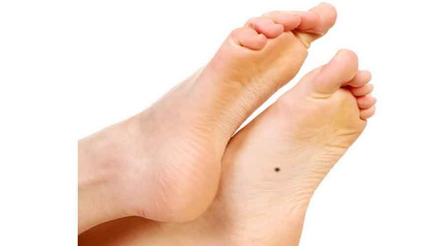 Foot Foot