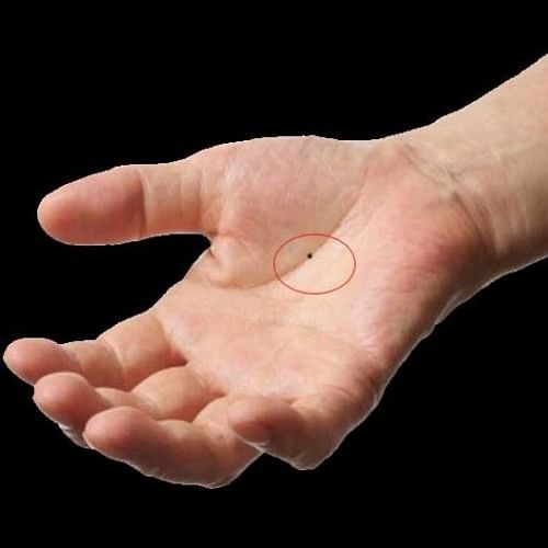 palmistry mole on hand meaning