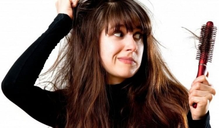 Tips to have dandruff free hair