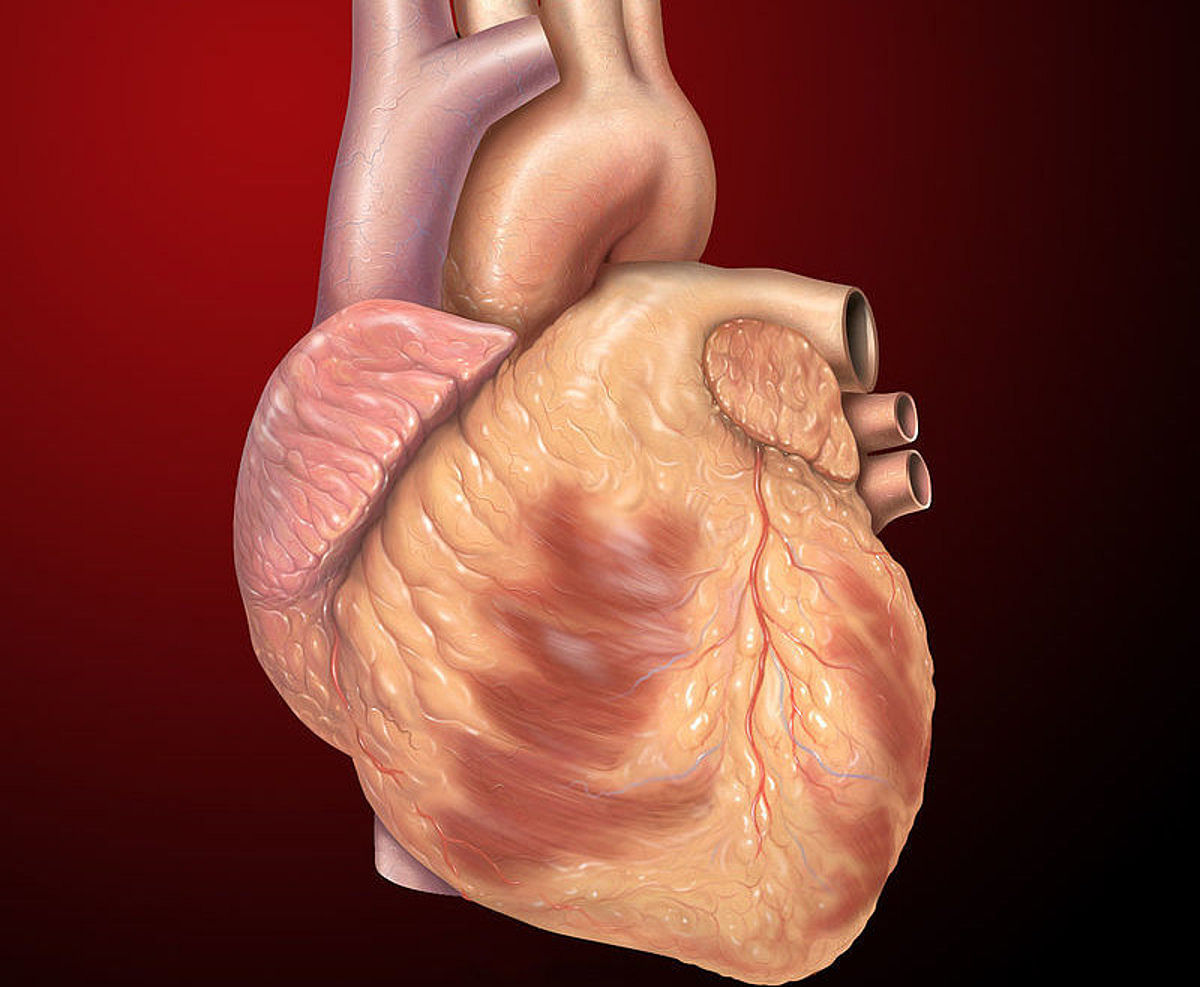 Artificial heart