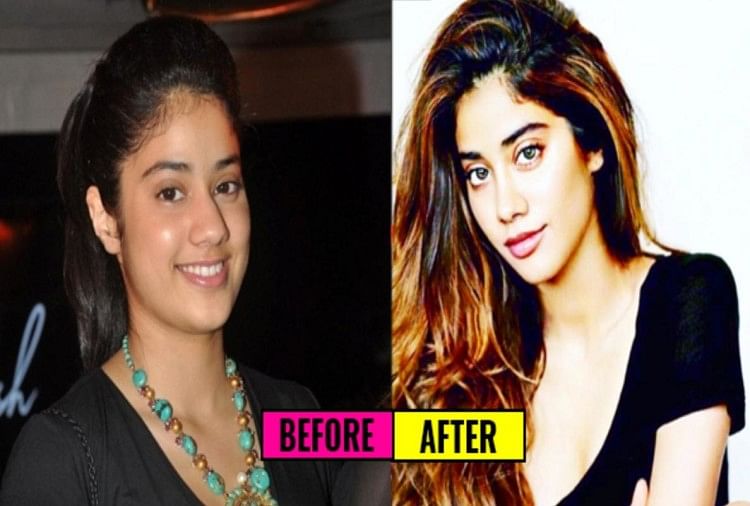 List Of Bollywood Actresses Who Have Had Plastic Surgery - प्लास्टिक