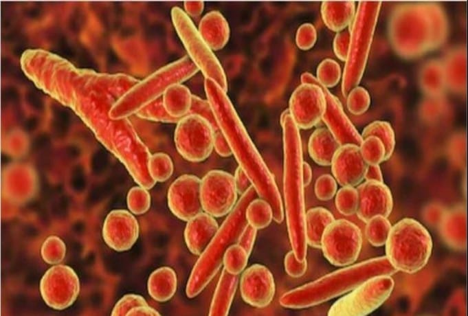 Mycoplasma genitalium
