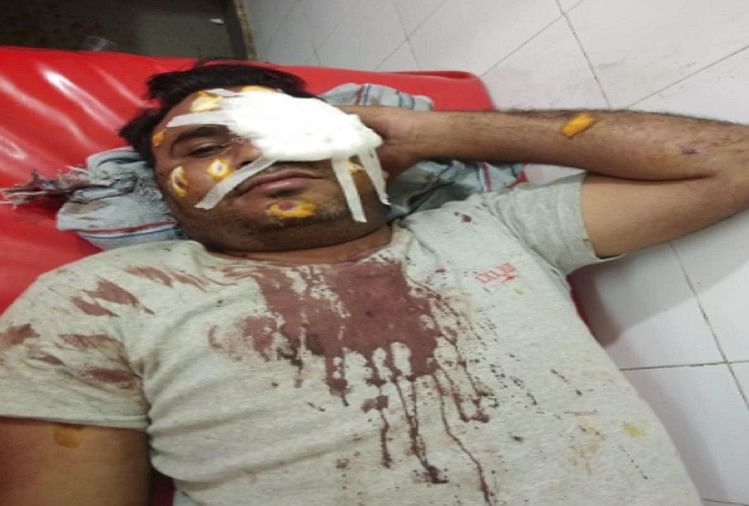 यूपी: दो पक्षों में खूनी संघर्ष, जमकर चले धारदार हथियार और फायरिंग, तीन लोग घायल अस्पताल में भर्ती घायल युवक