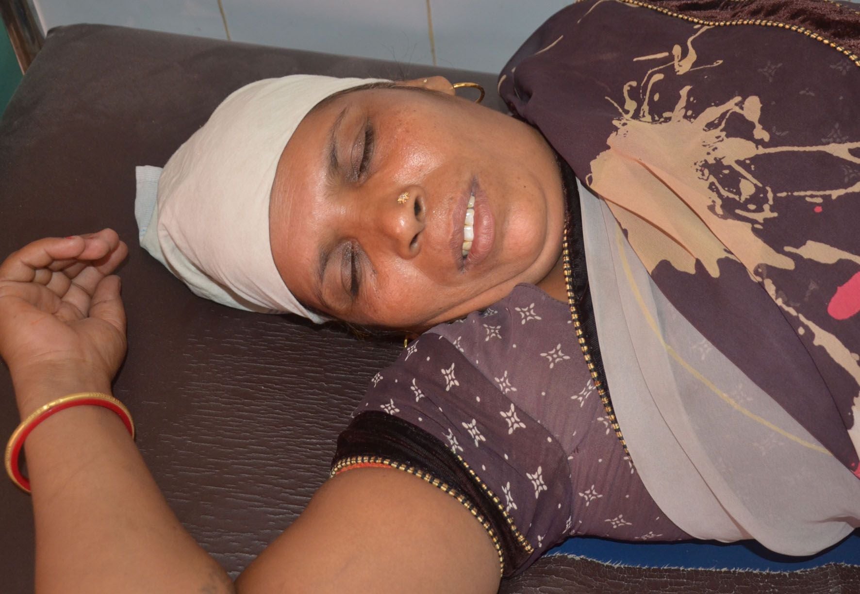 अकराबाद सड़क हादसे में घायल महिला। अकराबाद सड़क हादसे में घायल महिला।