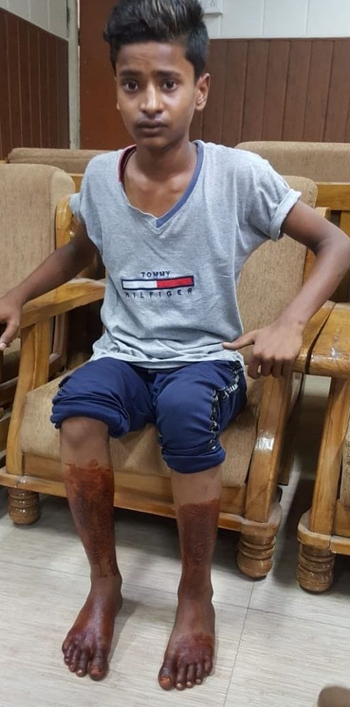 क्राइम की खबर के साथ लखनऊ के थाना पीजीआई की तेलीबागचौकी में दरोगा की पिटाई का शिकार किशोर क्राइम की खबर के साथ लखनऊ के थाना पीजीआई की तेलीबागचौकी में दरोगा की पिटाई का शिकार किशोर