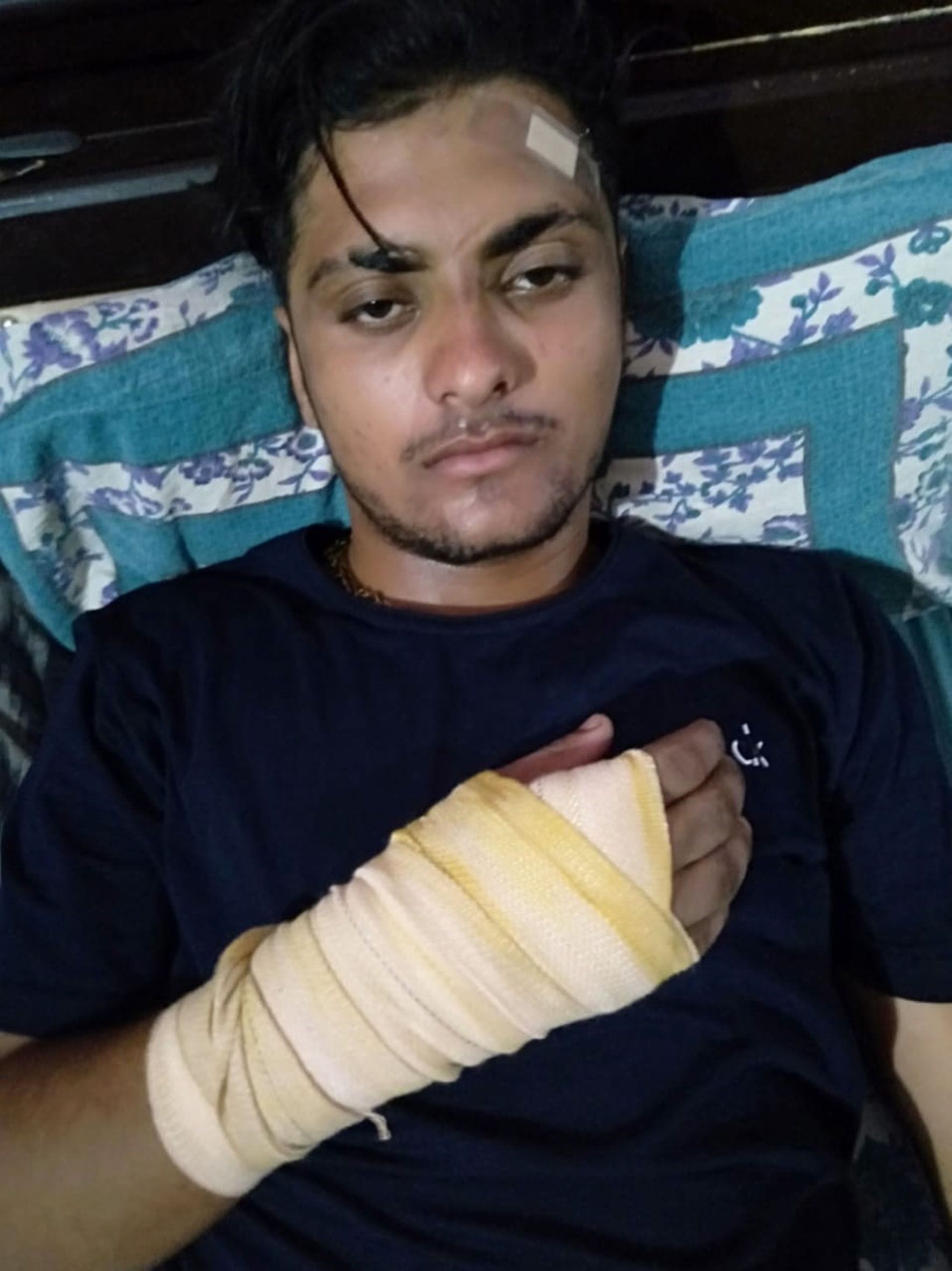  झगड़े में घायल युवक।