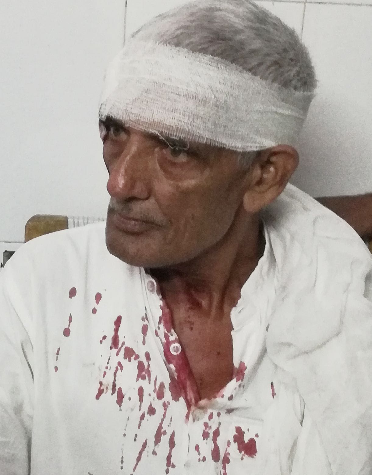 5ए-फलावदा के गांव दांदूपुर में मारपीट के दौरान घायल हुआ सतपाल। (फलावदा) 5ए-फलावदा के गांव दांदूपुर में मारपीट के दौरान घायल हुआ सतपाल। (फलावदा)