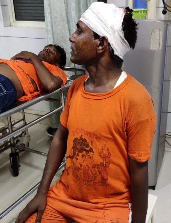 मेरठ-----सकौती ओवर ब्रिज पर देर रात हुए हादसे में घायल दिल्ली का घायल शिव भक्त मोदीपुरम के अस्पताल म मेरठ-----सकौती ओवर ब्रिज पर देर रात हुए हादसे में घायल दिल्ली का घायल शिव भक्त मोदीपुरम के अस्पताल म