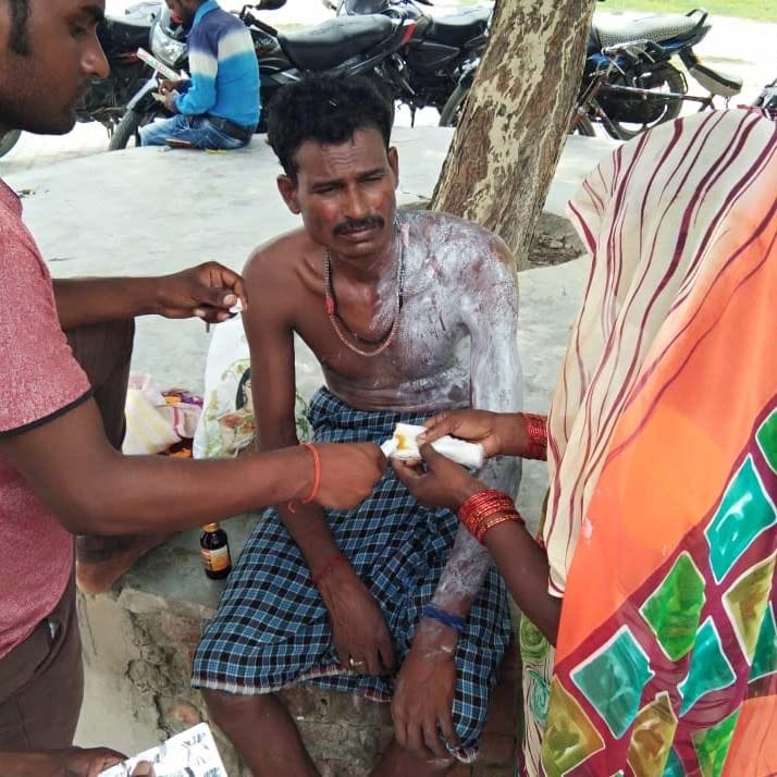 कुंडा के देवरी हरदो पट्टी गाव में गैस रिसाव से लगी आग में झुलसे युवक को मरहम लगाते परिजन।