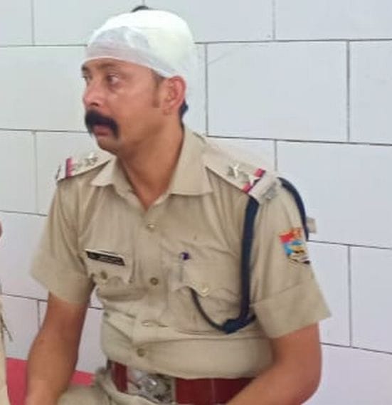 रुद्रपुर के छतरपुर में हुए पथराव में घायल दरोगा सुधाकर जोशी। रुद्रपुर के छतरपुर में हुए पथराव में घायल दरोगा सुधाकर जोशी।