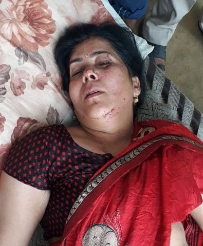 25srd51b- मेरठ करनाल हाईवे पर भूनी गांव में सड़क हादसे में घायल महिला।