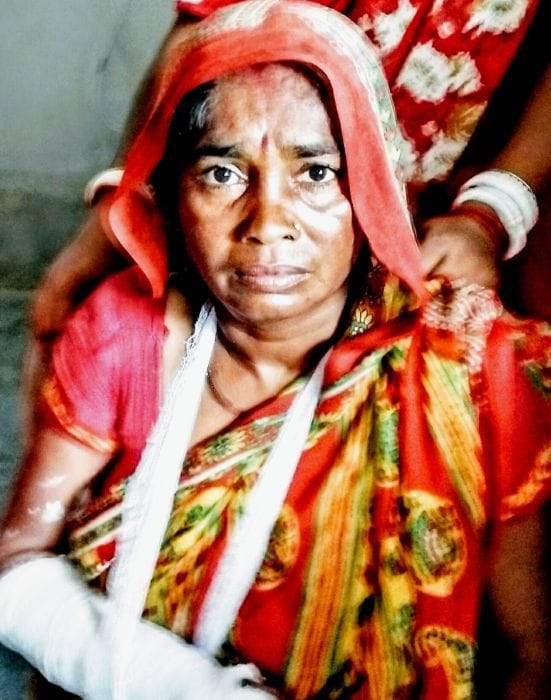 दिनेशपुर में सड़क हादसे में घायल महिला मजदूर। दिनेशपुर में सड़क हादसे में घायल महिला मजदूर।