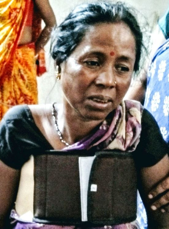 दिनेशपुर में सड़क हादस में घायल महिला मजदूर। दिनेशपुर में सड़क हादस में घायल महिला मजदूर।