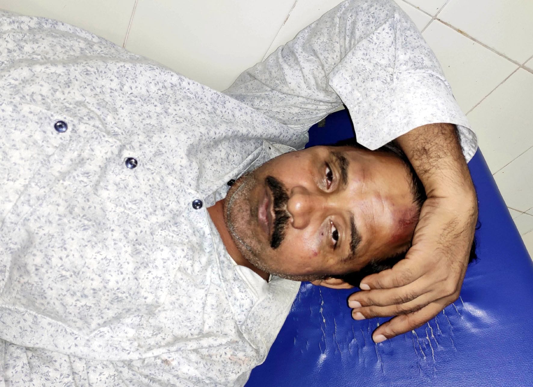 रेलवे स्टेशन पर हुयी मारपीट में घायल सहीद।