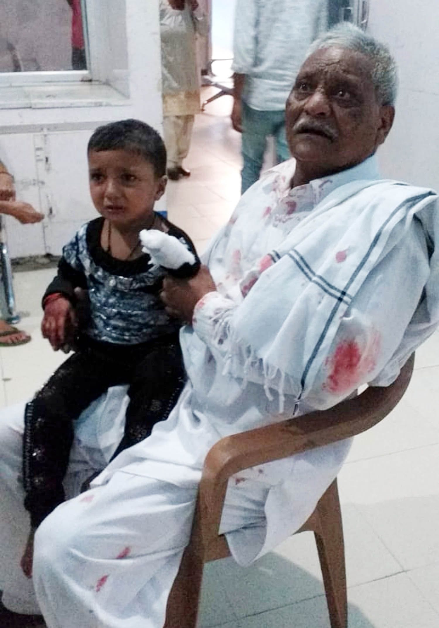  हादसे में घायल तीन वर्षीय बच्ची नैंसी। जिसके एक हाथ की अंगुलियां कट गईं।