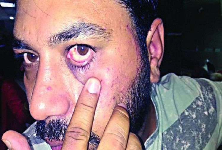 पत्रकार राहुल कादयान को पुलिस ने पीटा