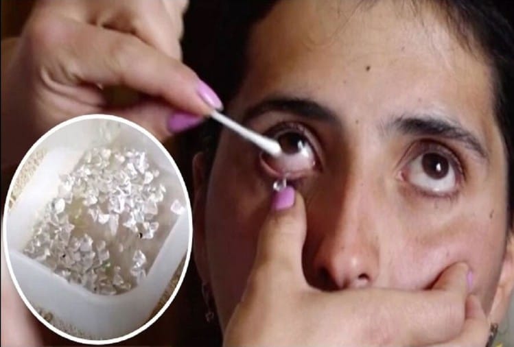 Strange Medical Case Of A Woman Who Cries Crystal Tears Every Day