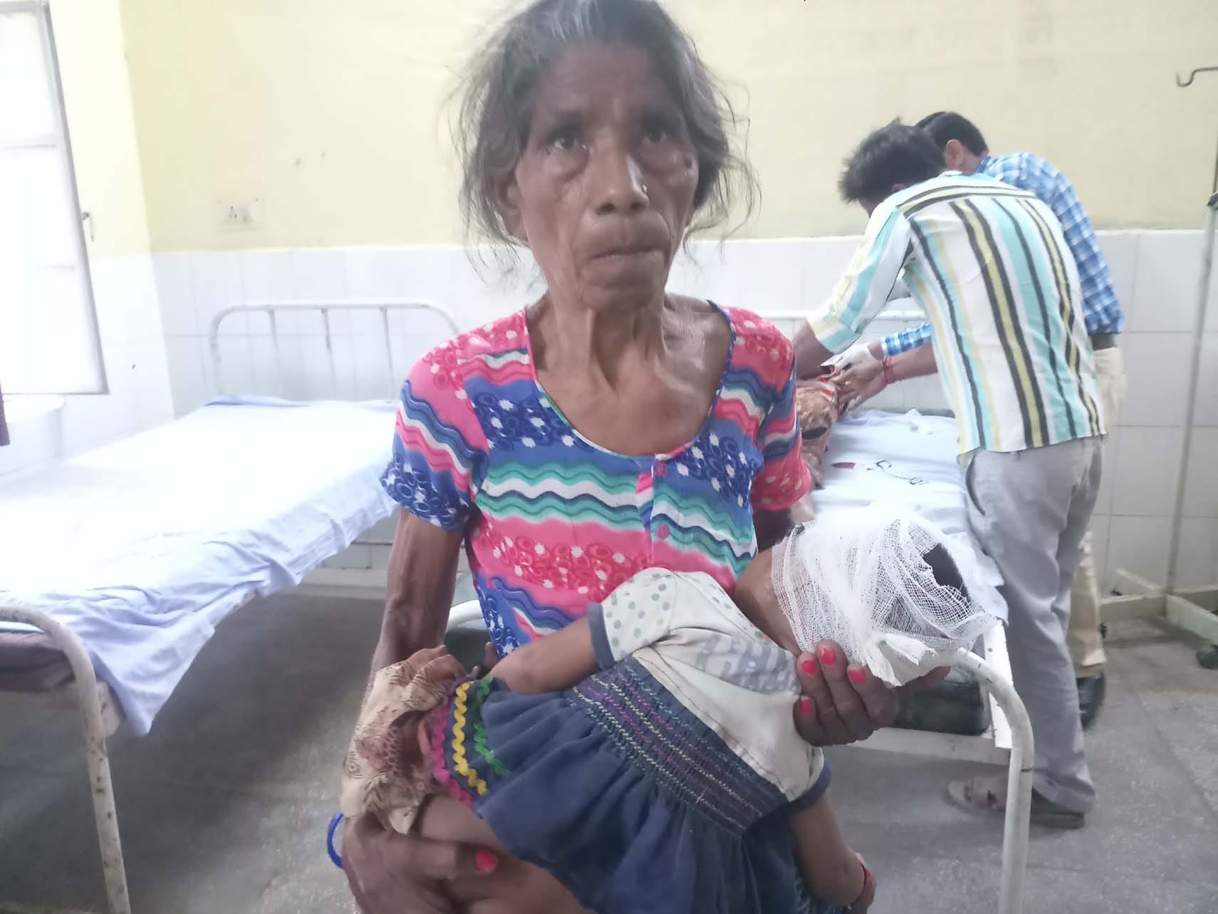 सराना- मैक्स की चपेट में आकर घायल हुई बच्ची