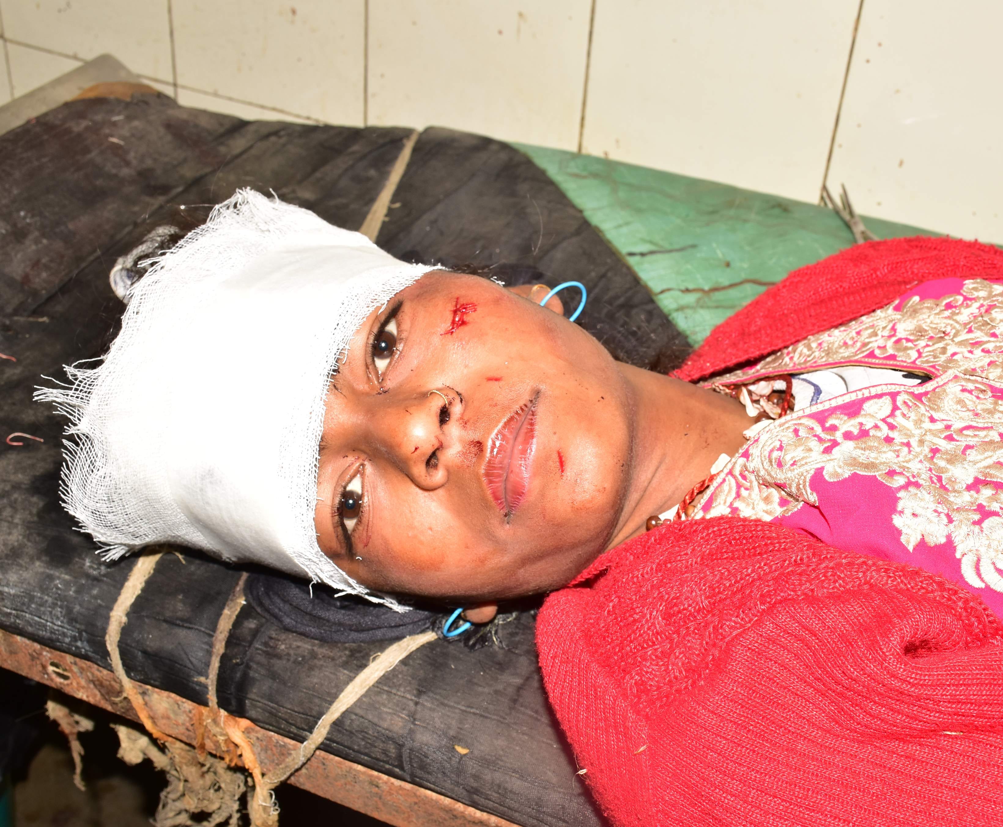 हल्द्वानी बेस अस्पताल में भर्ती रौसिला में सड़क दुर्घटना में घायल मंजू आर्य। अमर उजाला हल्द्वानी बेस अस्पताल में भर्ती रौसिला में सड़क दुर्घटना में घायल मंजू आर्य। अमर उजाला