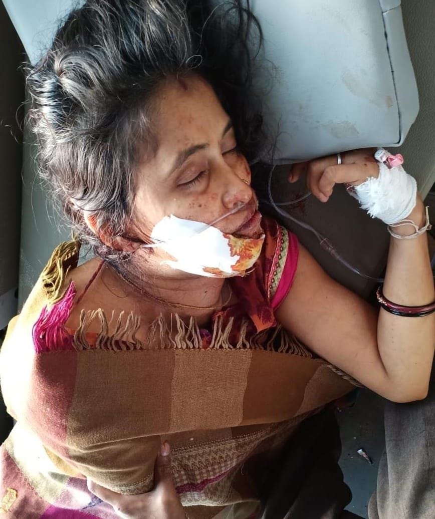 घायल रानी गुप्ता घायल रानी गुप्ता