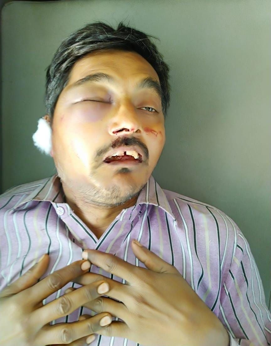 घायल राजेश घायल राजेश