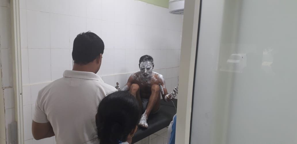 गैस चूल्हा खुला छोड़ने की वजह से तीली जलाते ही आग पकड़ने से झुलसा व्यक्ति। गैस चूल्हा खुला छोड़ने की वजह से तीली जलाते ही आग पकड़ने से झुलसा व्यक्ति।
