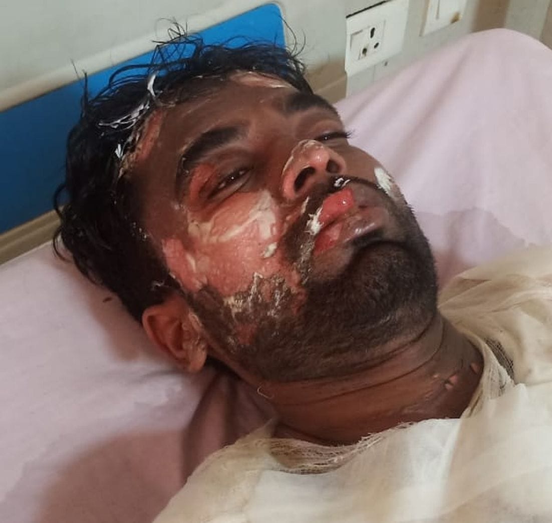 काशीपुर के निजी अस्पताल में भर्ती घायल। काशीपुर के निजी अस्पताल में भर्ती घायल।
