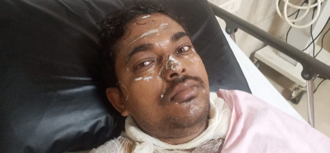 काशीपुर के निजी अस्पताल में भर्ती घायल। काशीपुर के निजी अस्पताल में भर्ती घायल।