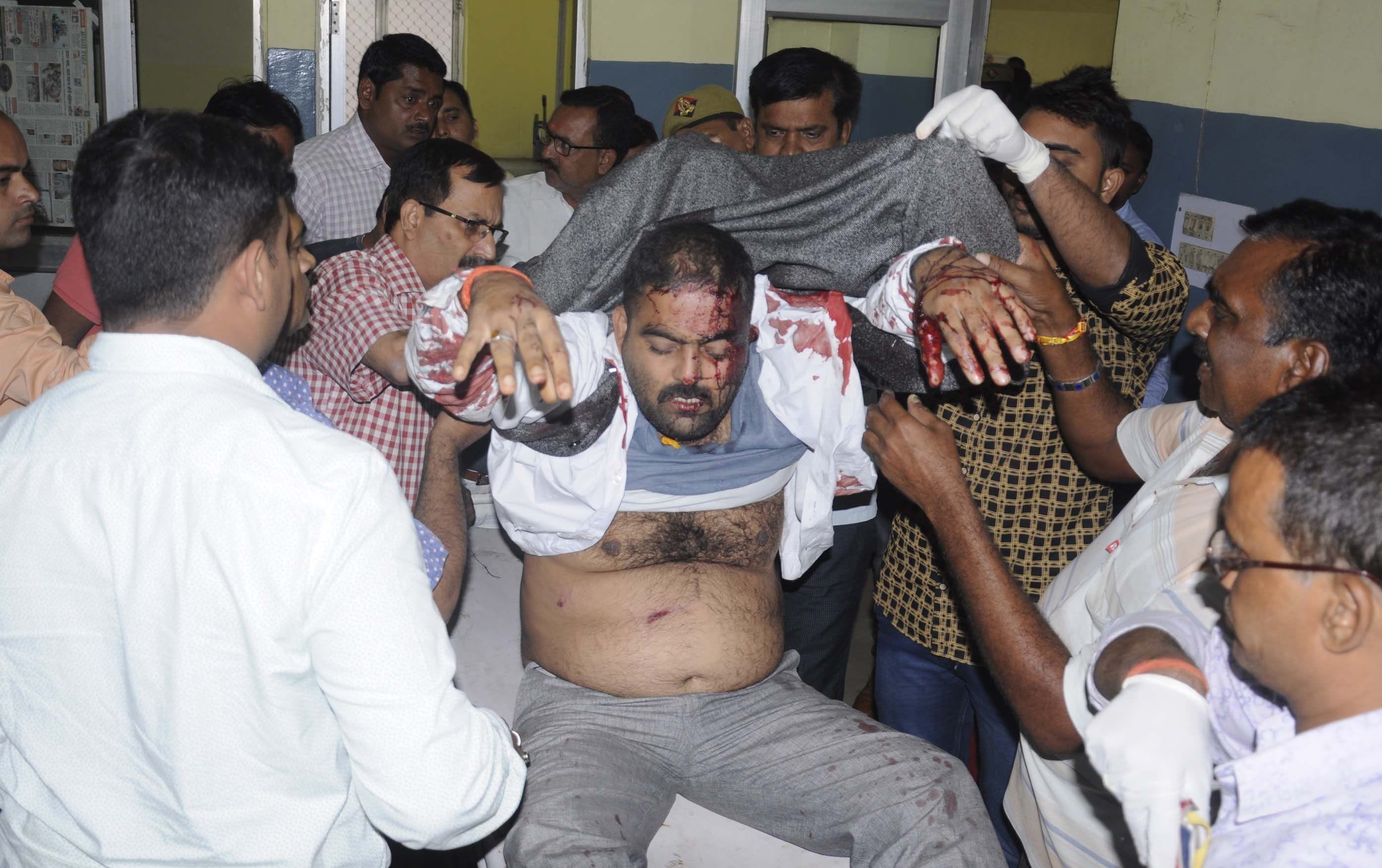 ठिावर बाजार में बदमाशों की गोली से घायल कैबिनेट मंत्री के रिश्तेदार सर्वेश सिंह का जिला अस्पताल ? ठिावर बाजार में बदमाशों की गोली से घायल कैबिनेट मंत्री के रिश्तेदार सर्वेश सिंह का जिला अस्पताल ?