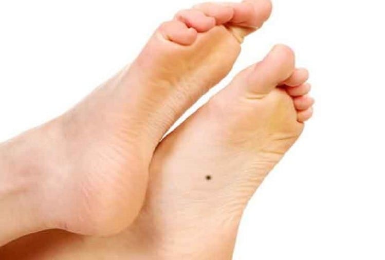 Body Mole Meaning And Importance शरीर के किस अंग पर तिल होने का क्या