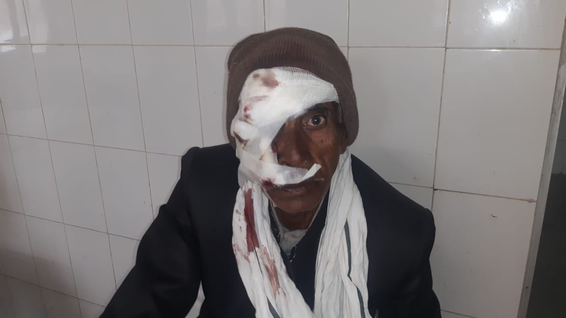 फोटो 7 एक्सप्रेस वे परघायल हुए-लालता सिंह फोटो 7 एक्सप्रेस वे परघायल हुए-लालता सिंह