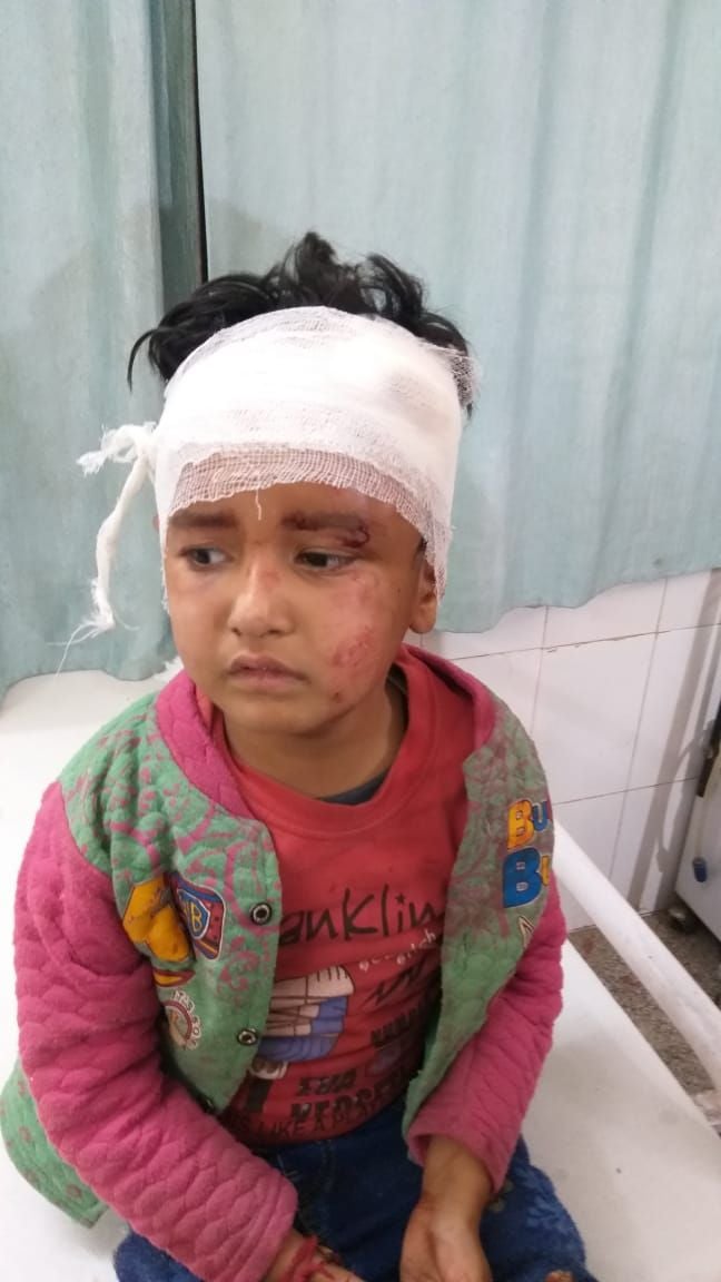 हादसे में घायल बच्चा।