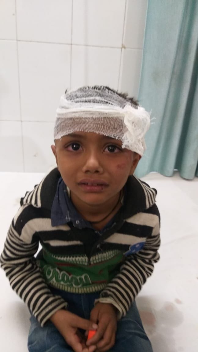 हादसे में घायल बच्चा।