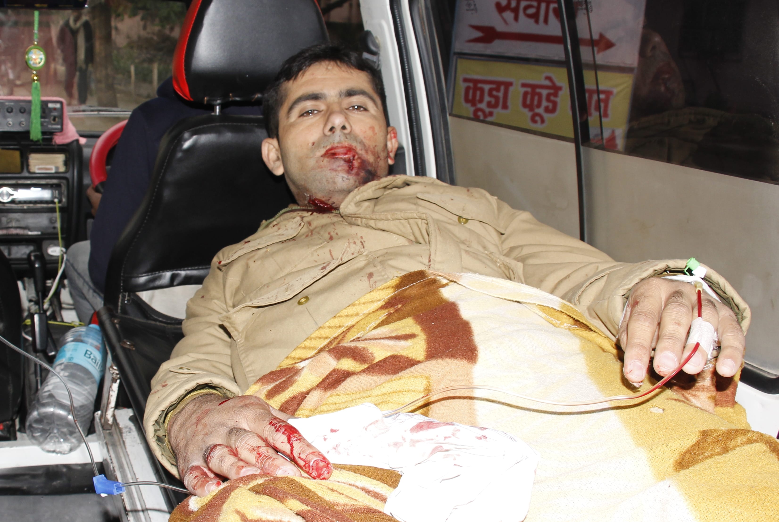 बिजनौर में जजी में सीजेएम कोर्ट में गोली से घायल पुलिसकर्मी मनीष। बिजनौर में जजी में सीजेएम कोर्ट में गोली से घायल पुलिसकर्मी मनीष।