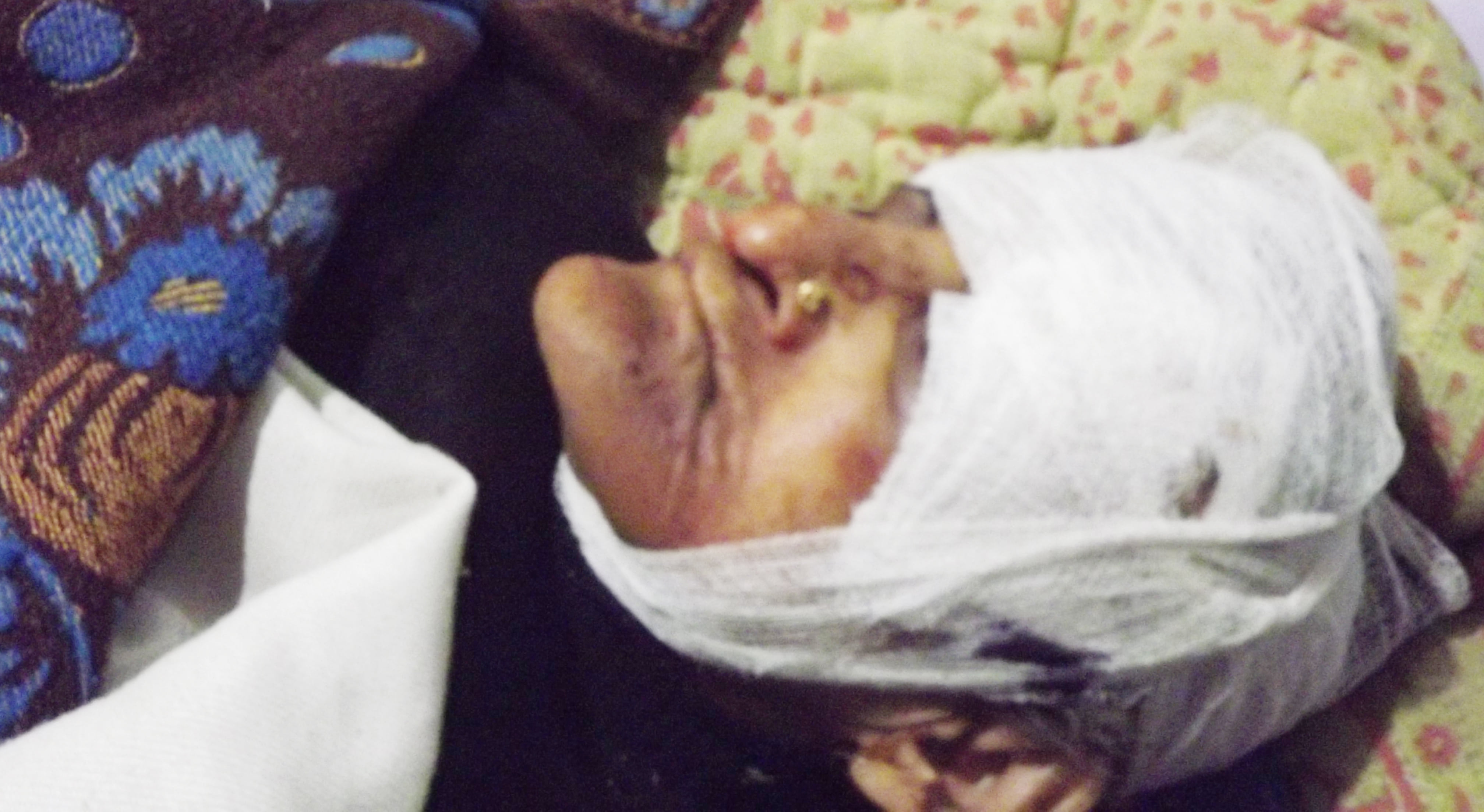 घायल बुजुर्ग महिला घायल बुजुर्ग महिला