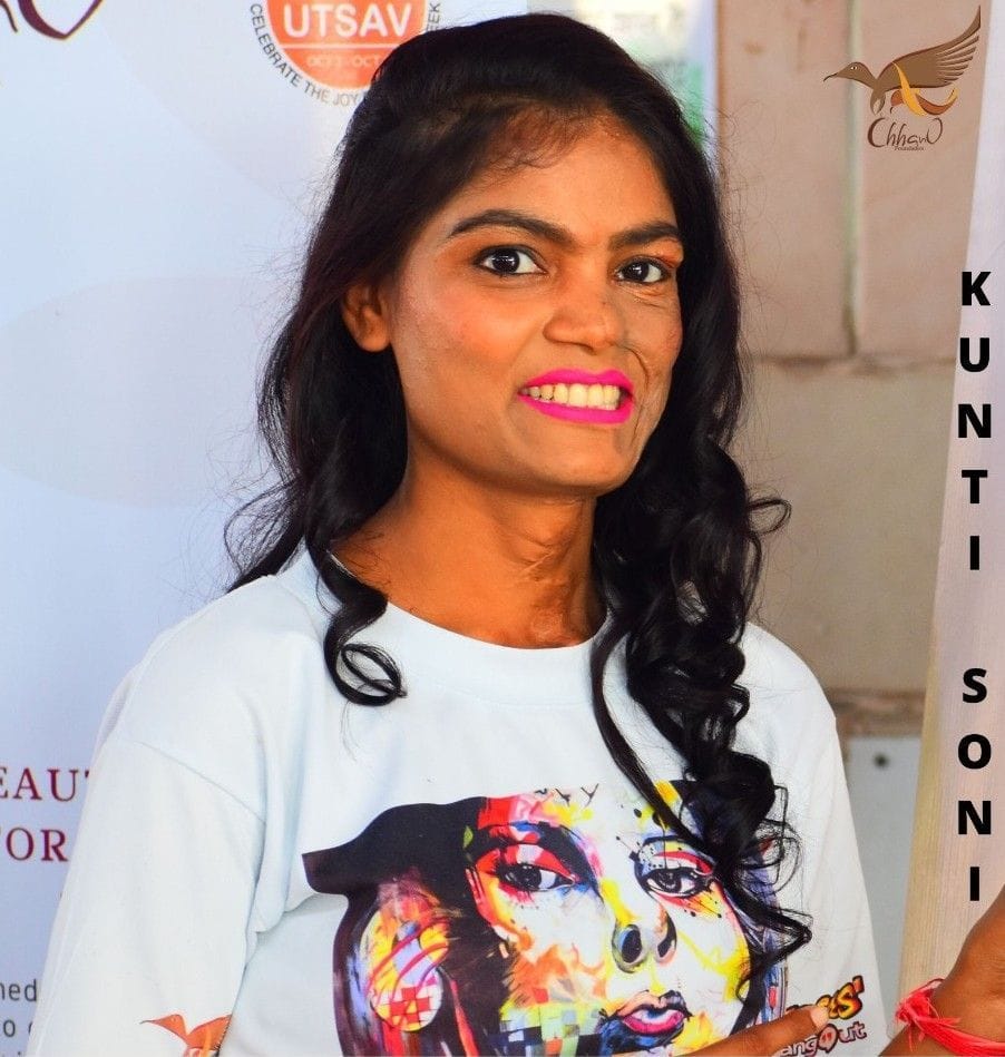 छपाक फिल्म में डेब्यू कर रहीं लखनऊ निवासी कुंति छपाक फिल्म में डेब्यू कर रहीं लखनऊ निवासी कुंति