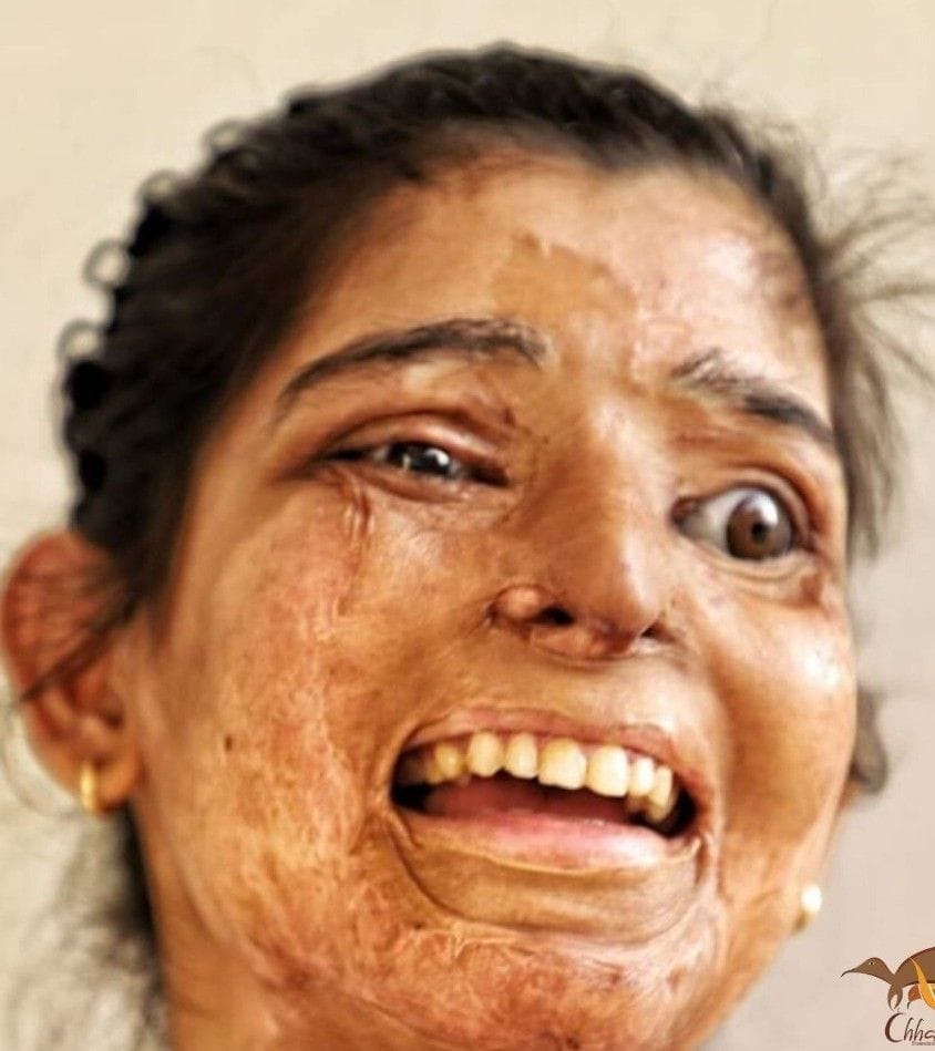 छपाक फिल्म में डेब्यू कर रहीं रोहतक निवासी रितु। छपाक फिल्म में डेब्यू कर रहीं रोहतक निवासी रितु।