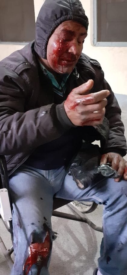 दुर्घटना में घायल स्कूटर सवार व्यक्ति। दुर्घटना में घायल स्कूटर सवार व्यक्ति।