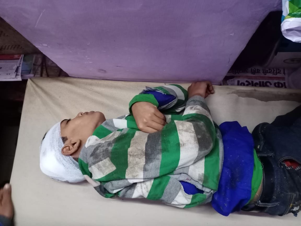 बंदरों को काटने से घायल हुए लोग बंदरों को काटने से घायल हुए लोग