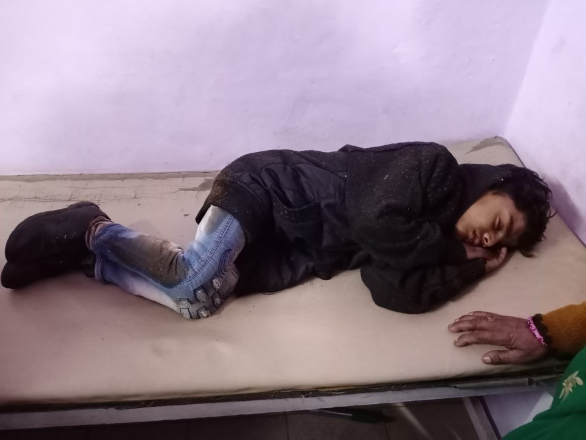 बंदरों को काटने से घायल हुए लोग बंदरों को काटने से घायल हुए लोग