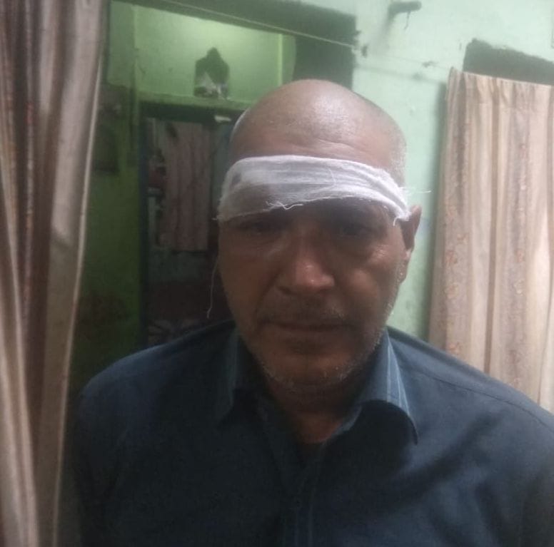 बंदरों को काटने से घायल हुए लोग बंदरों को काटने से घायल हुए लोग