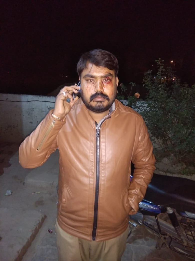 गौहनिया पेट्रोल पंप पर हुई लूट में बदमाशों के हमले से घायल मैनेजर सर्वेश सिंह व पेट्रोल पंप
