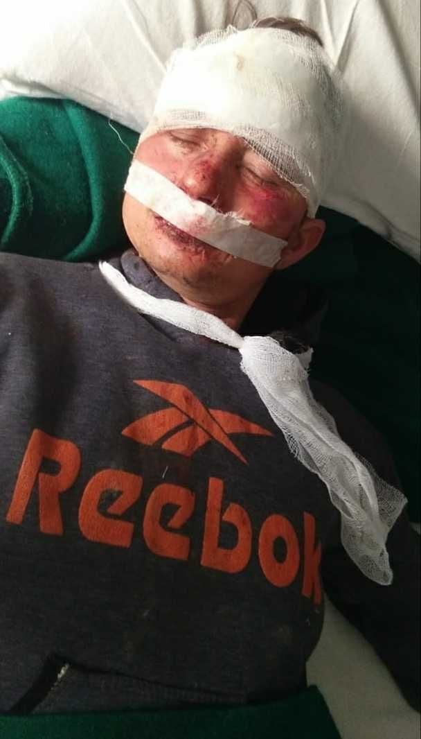 कैंटर हादसे का घायल ड्राइवर दीपक सिंह। कैंटर हादसे का घायल ड्राइवर दीपक सिंह।