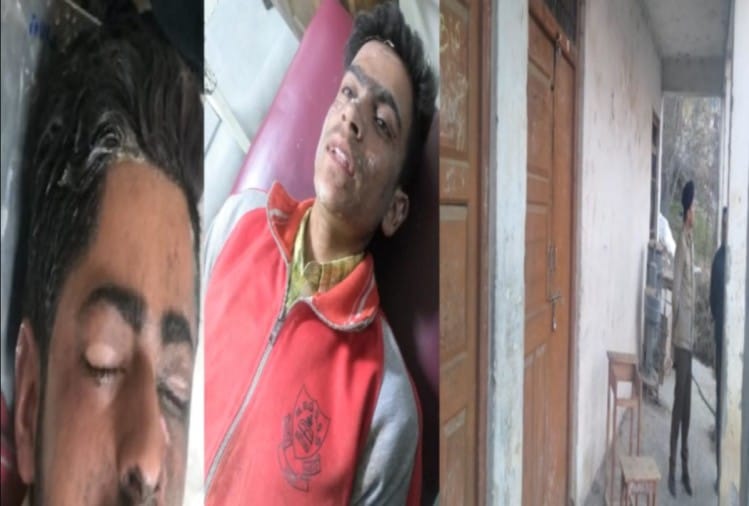 लैब में धमाके में घायल विद्यार्थी