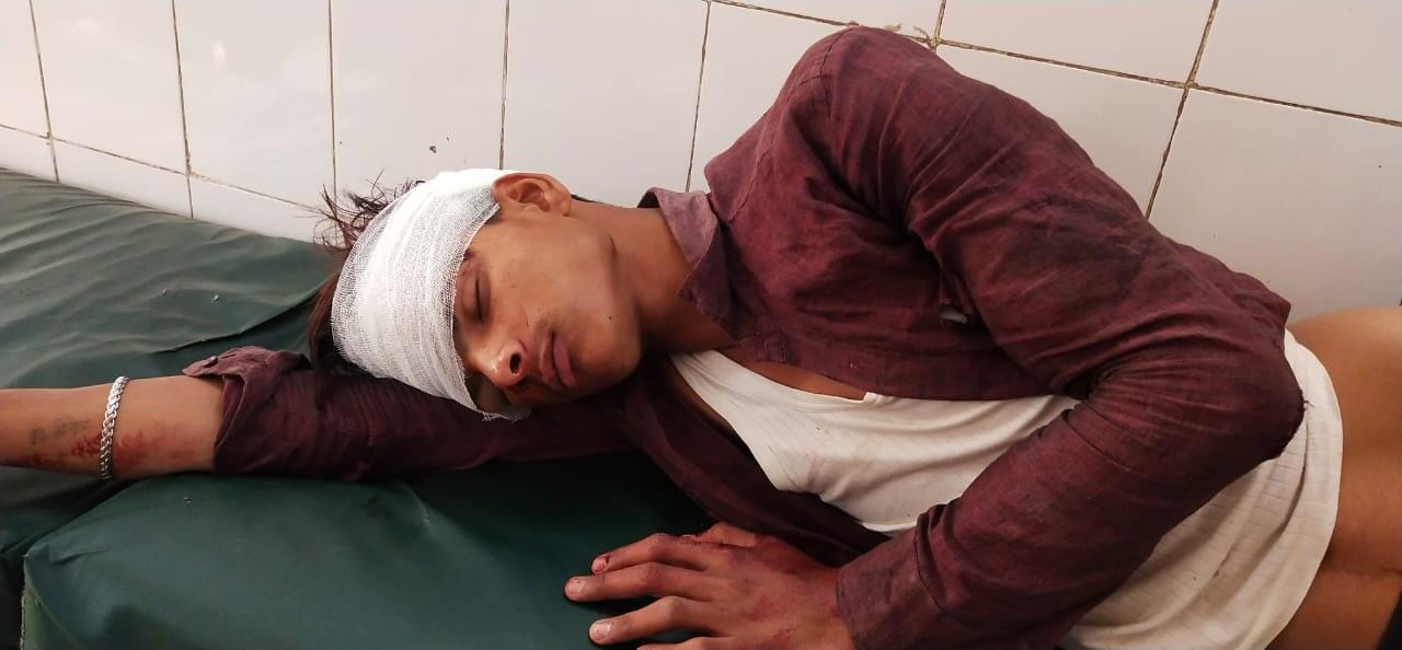 घायल प्रिंस घायल प्रिंस