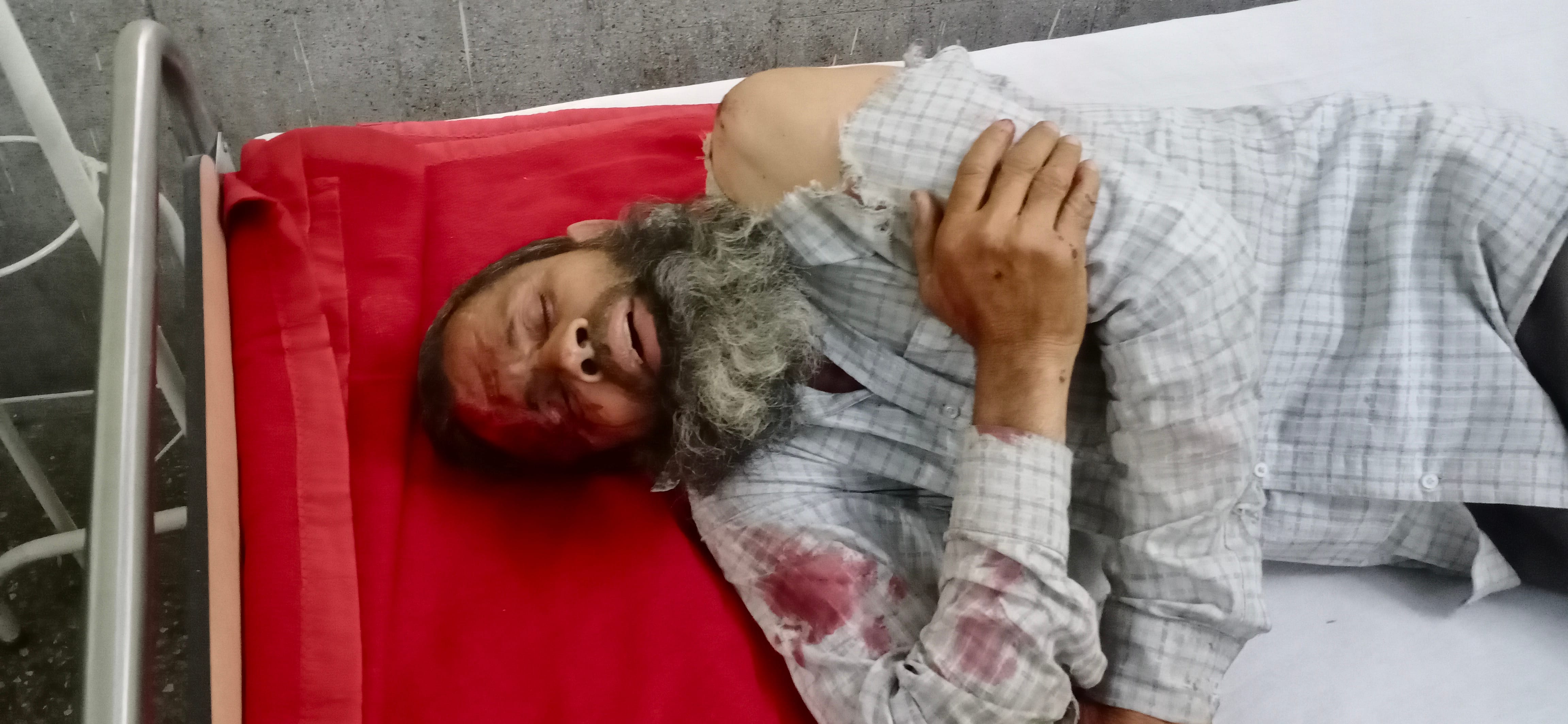 जानसठ में गाड़ी पलटने से घायल मजदूर। जानसठ में गाड़ी पलटने से घायल मजदूर।