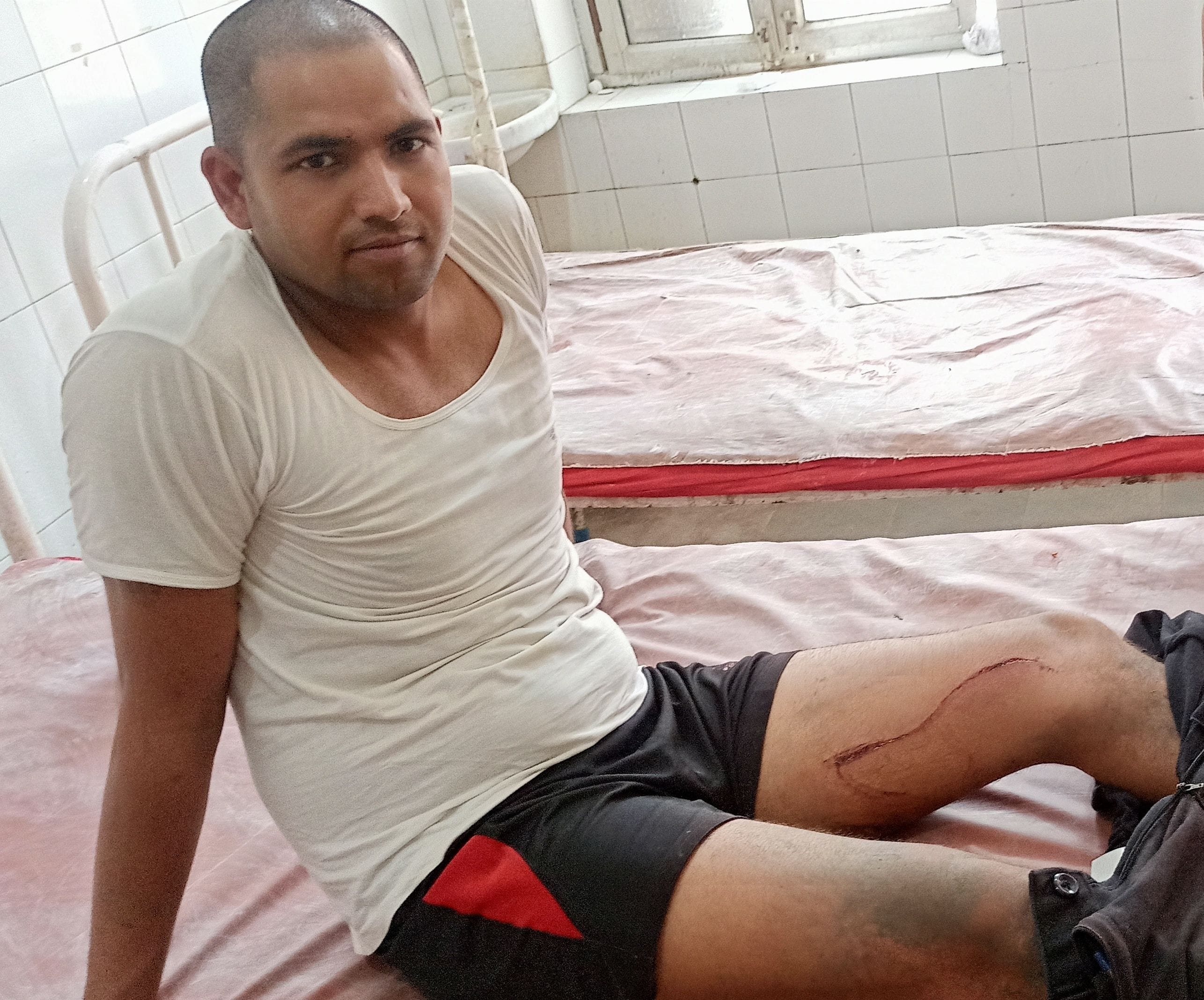 घायल कैलाश। घायल कैलाश।