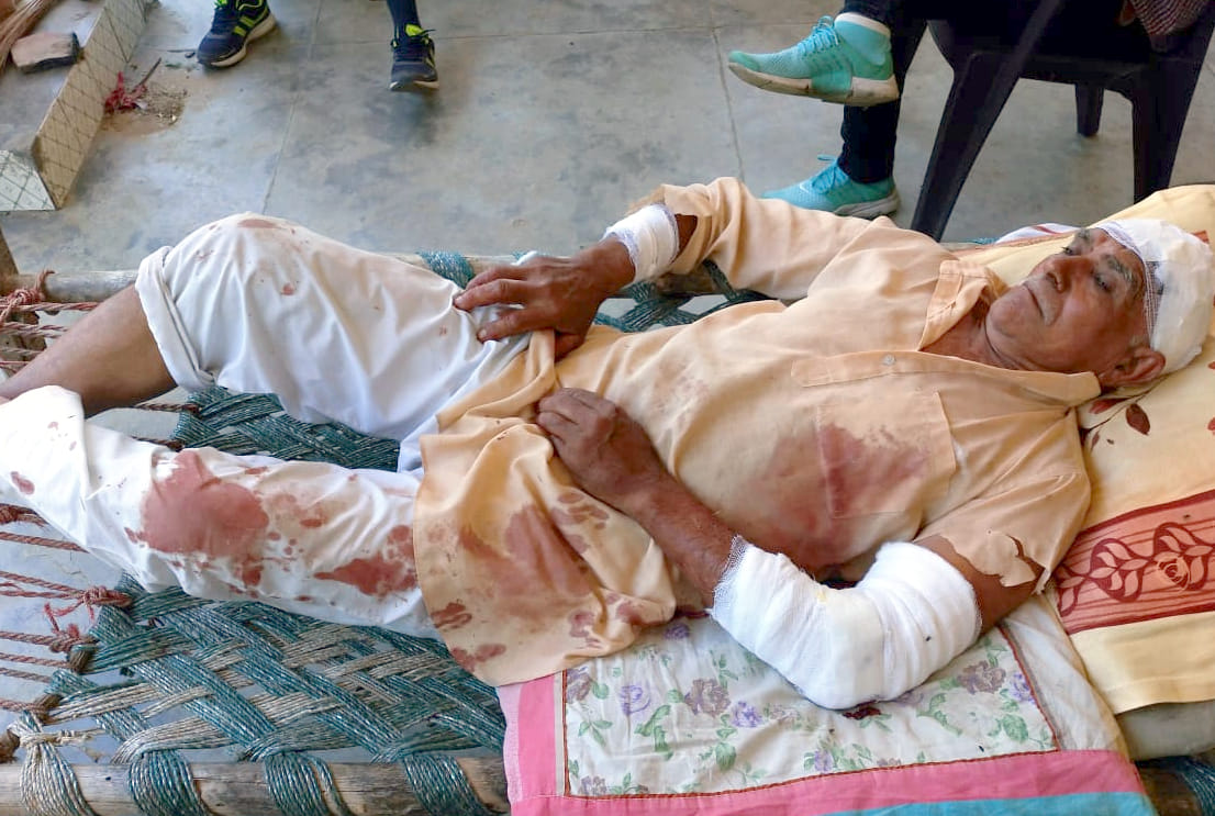 बिजनौर में चांदपुर के गांव मिर्जापुर बकैना में गुलदार के हमले में घायल ग्रामीण। बिजनौर में चांदपुर के गांव मिर्जापुर बकैना में गुलदार के हमले में घायल ग्रामीण।